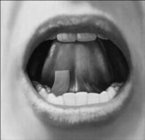 Buprenorphine film being dissolved under the tongue